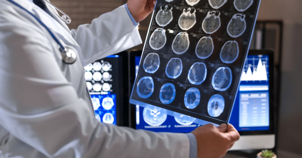 Traumatic Brain Injuries (TBI): How Car Accidents Lead to TBIs and ...